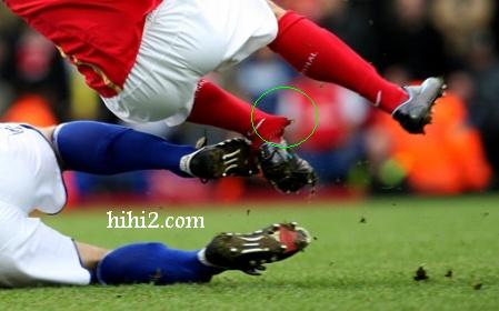 arsenal contre berghamcity